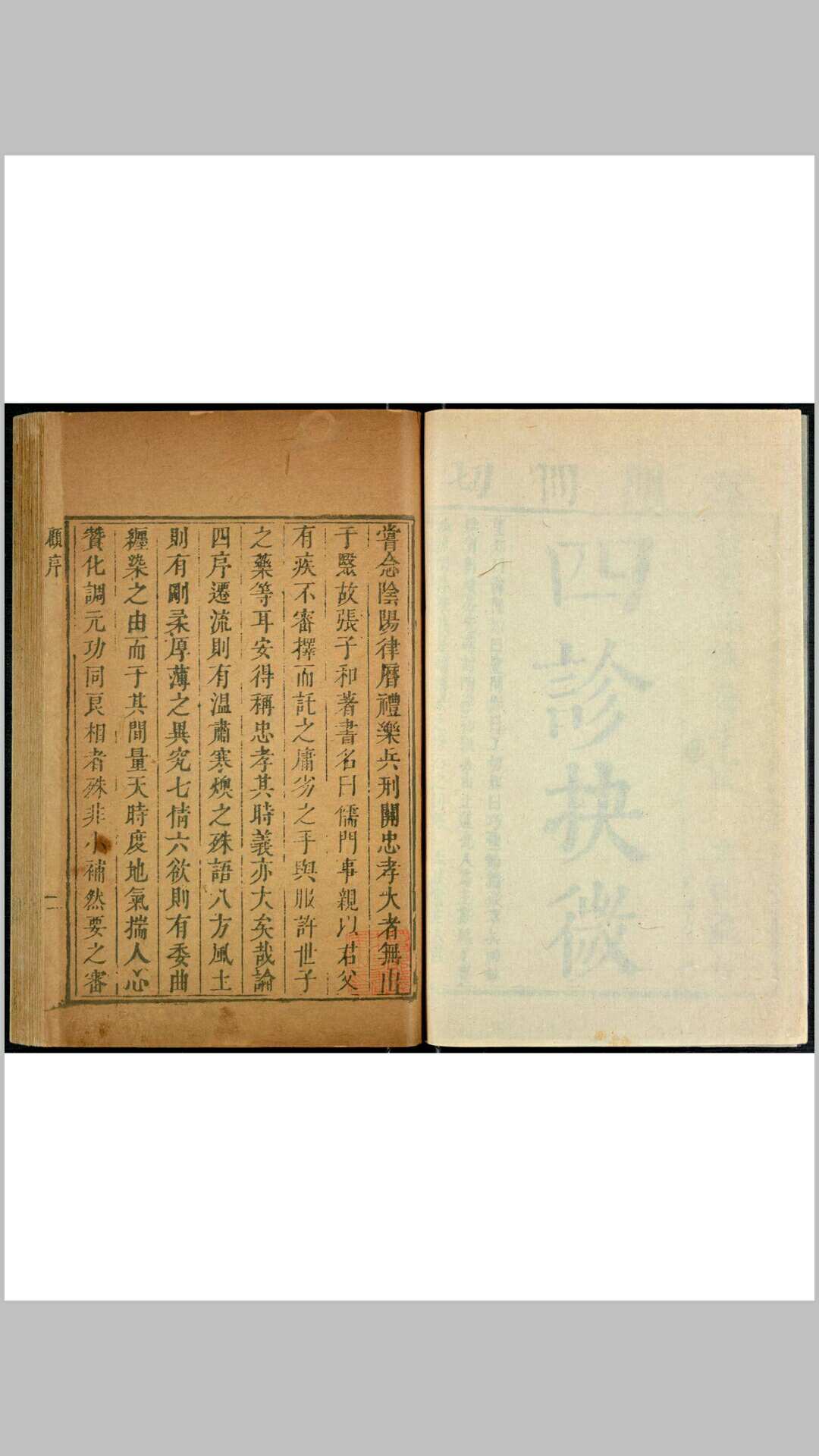 四诊抉微 八卷, 管窥附馀