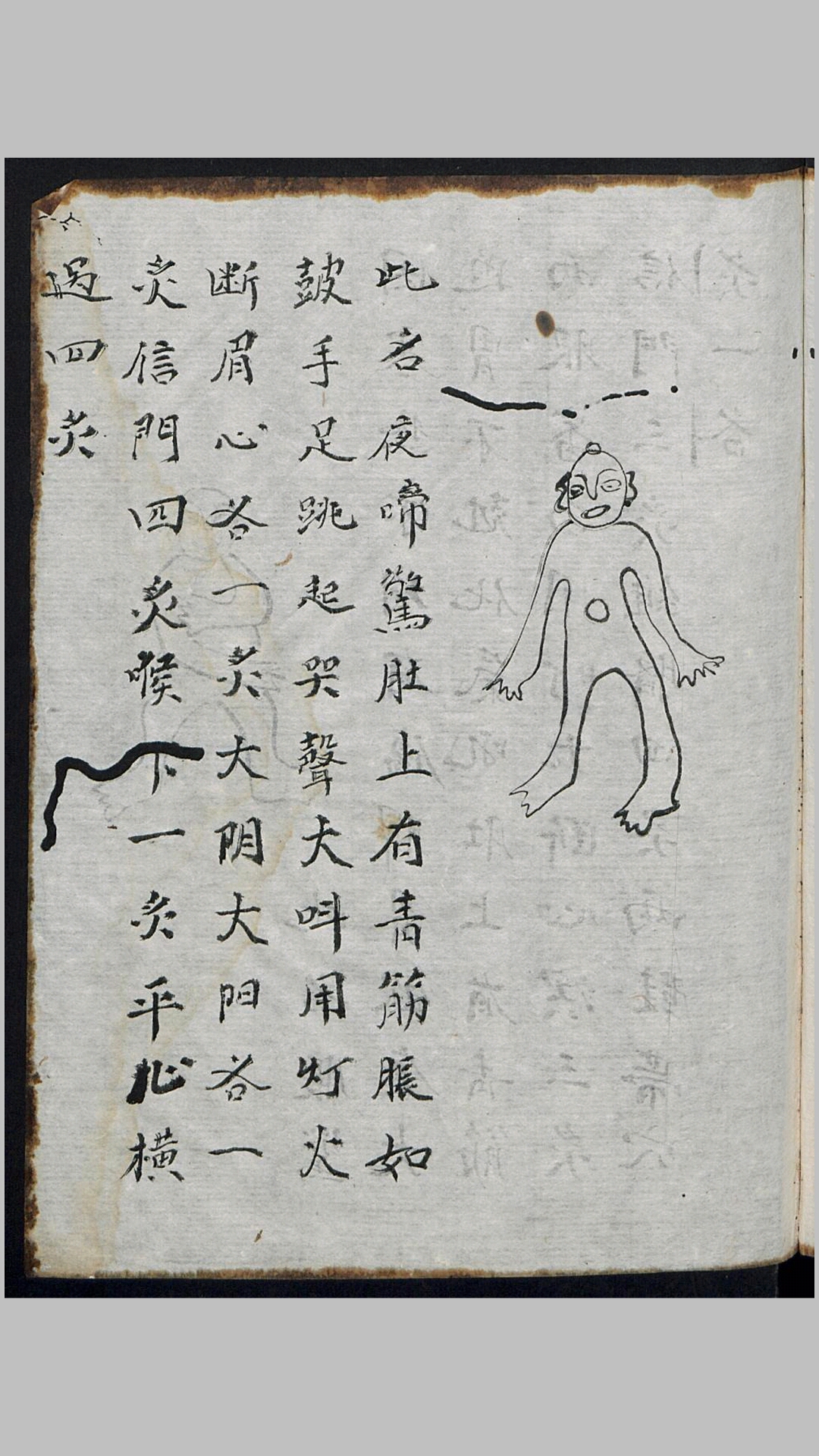 火