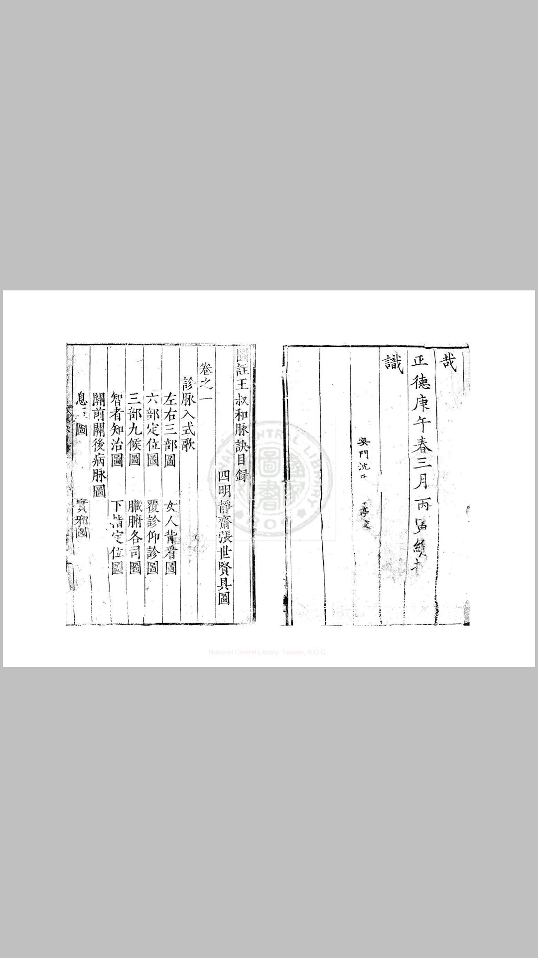 图注王叔和脉诀 四卷, 附方一卷 (晋)王叔和撰 (明)张世贤注 明嘉靖间(15221566)刊本