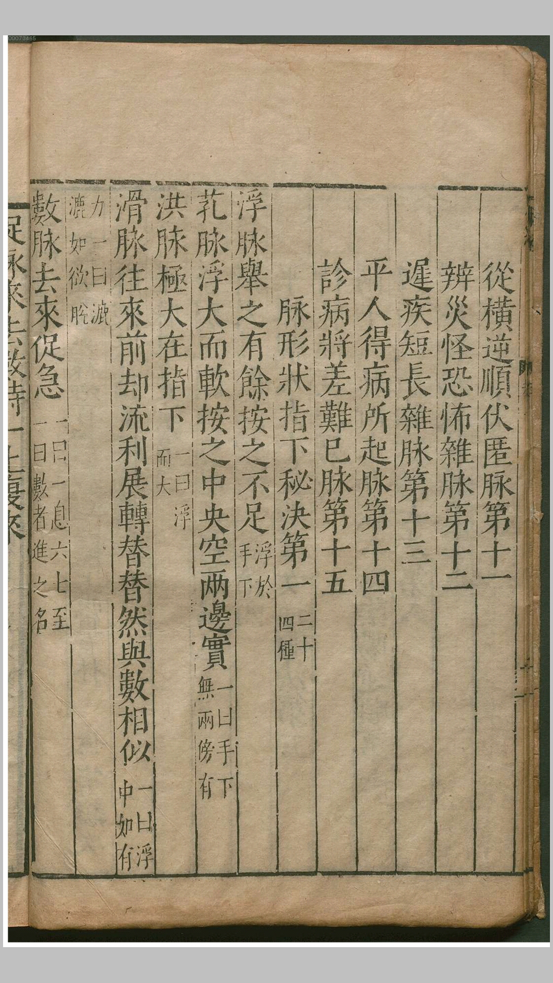 脉经