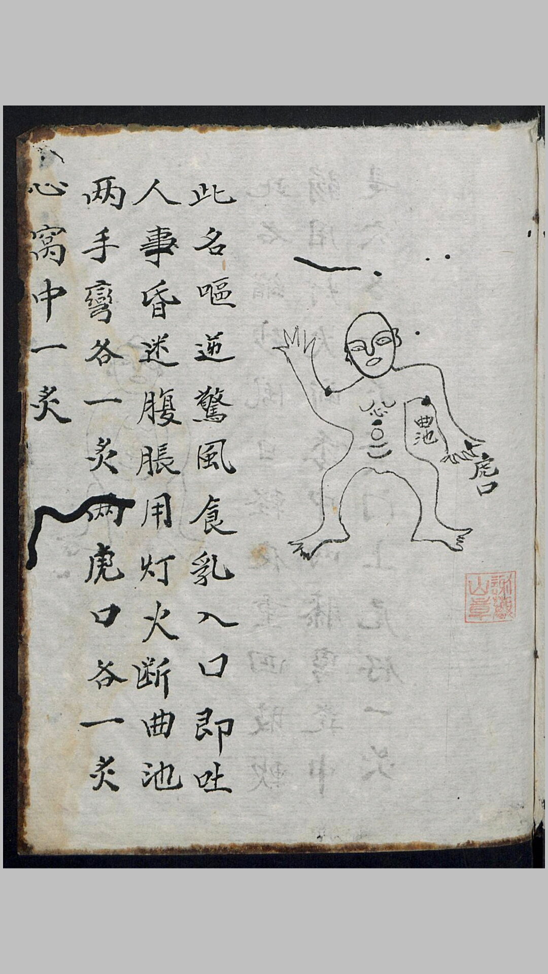 火
